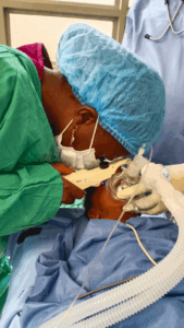Dr. Rebecca using Perkins Tonometer in Uganda